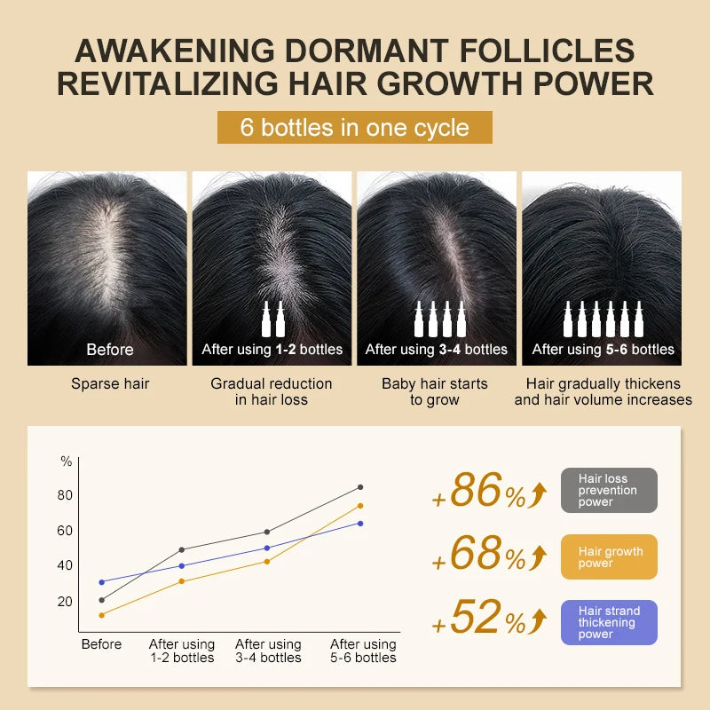 PURC Biotin Hair Growth Products for Man Women Anti Hair Loss Oil Scalp Treatment Serum Spray Thicken Fast Regrowth Hair Care