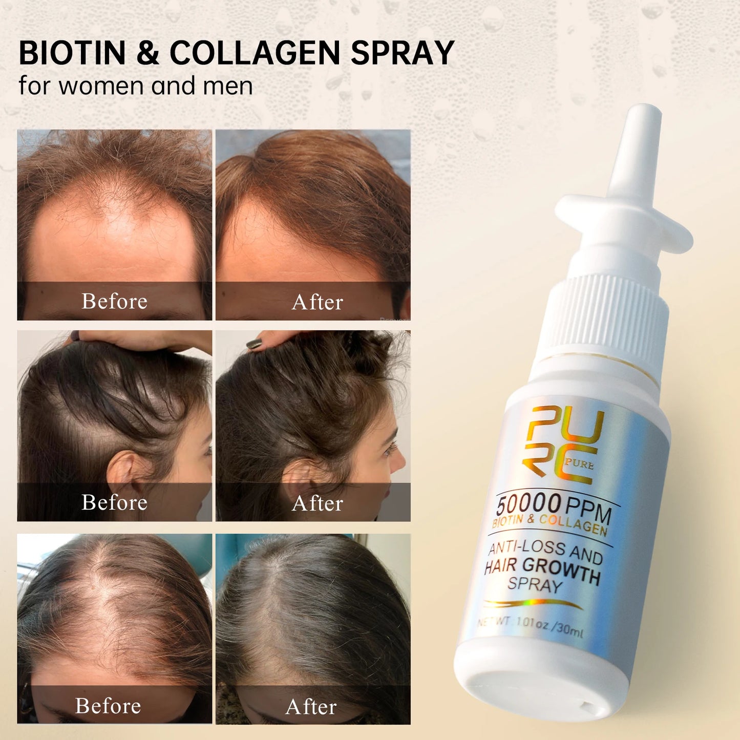 PURC Biotin Hair Growth Products for Man Women Anti Hair Loss Oil Scalp Treatment Serum Spray Thicken Fast Regrowth Hair Care
