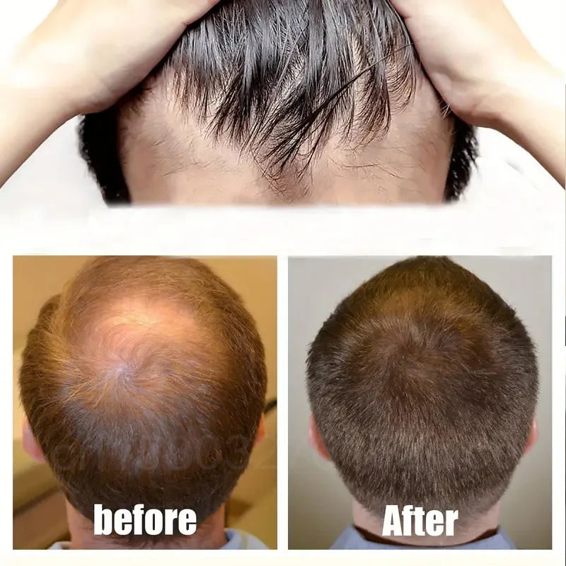 Fast Hair Growth Men Women Ginger Growth Hair Oil Treatment Anti Hair Loss Scalp Treatment Serum Products Beauty Health